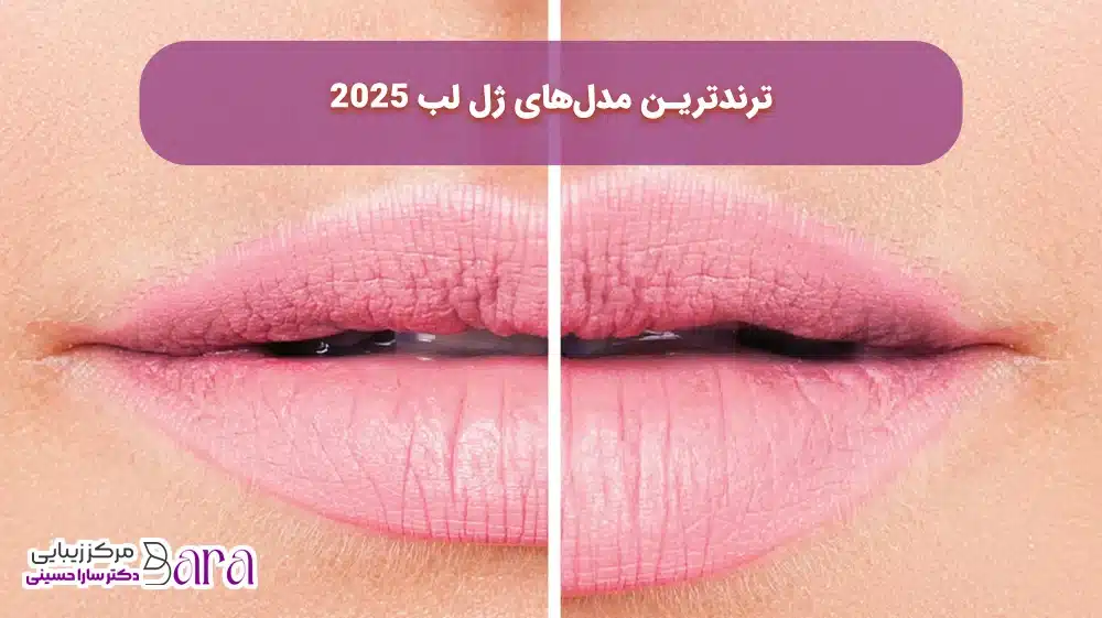 انواع ژل لب ترند سال 2025