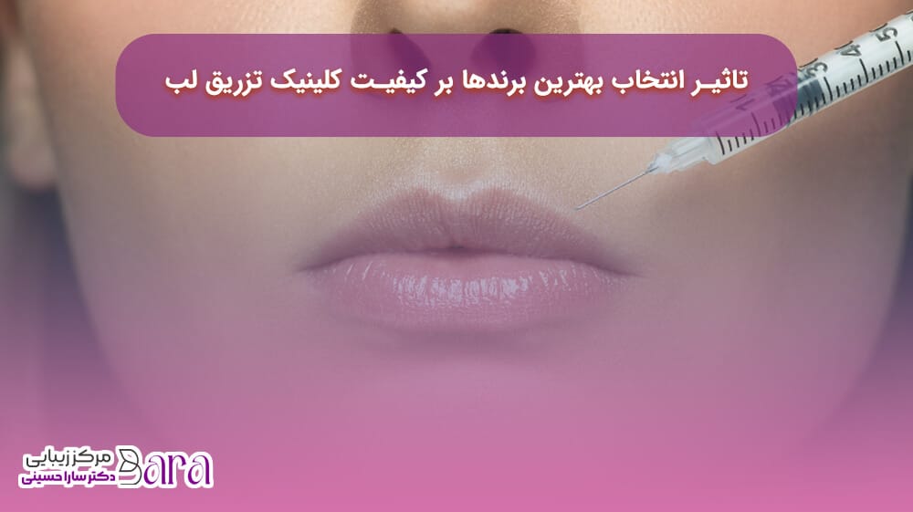 استفاده از بهترین برندهای ژل لب در بهترین کلینیک زیبایی