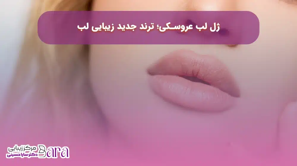 ژل لب عروسکی از انواع ترند ژل لب سال 2025