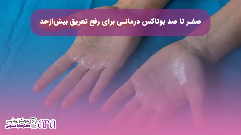 رفع تعریق با بوتاکس