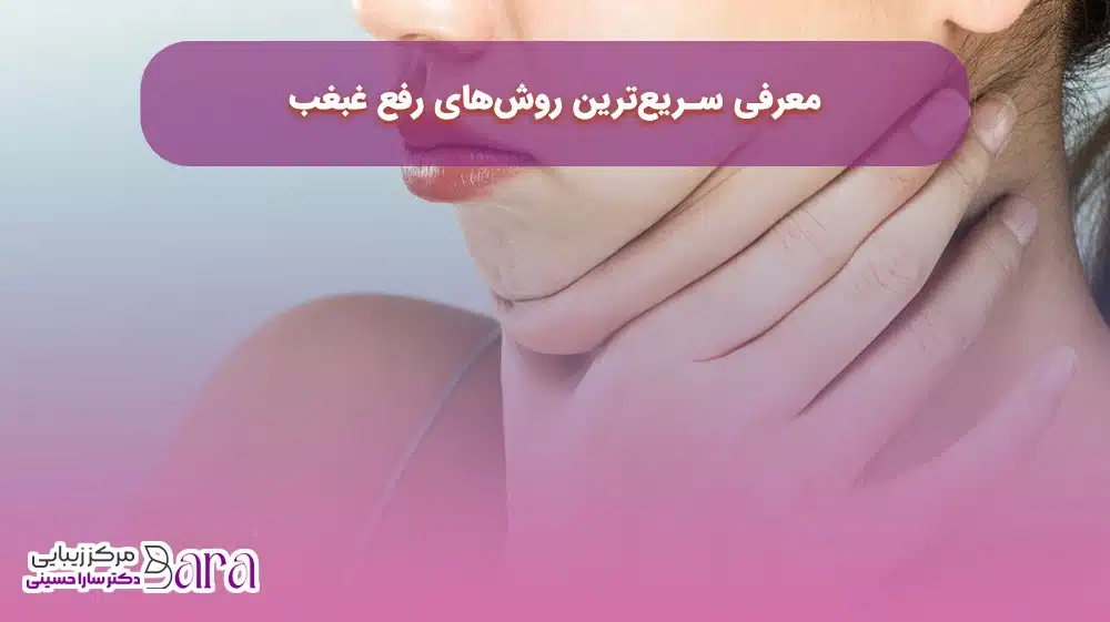 رفع غبغب