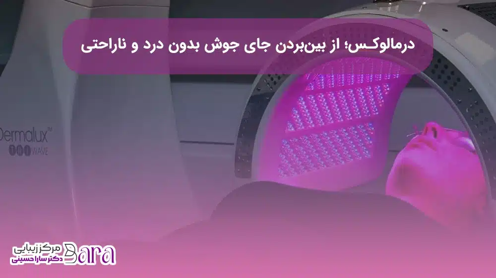 از بین بردن جای جوش با درمالوکس