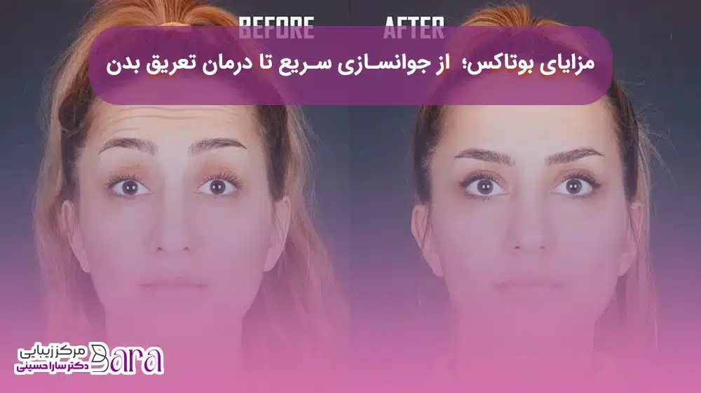 مزایا و کاربرد بوتاکس