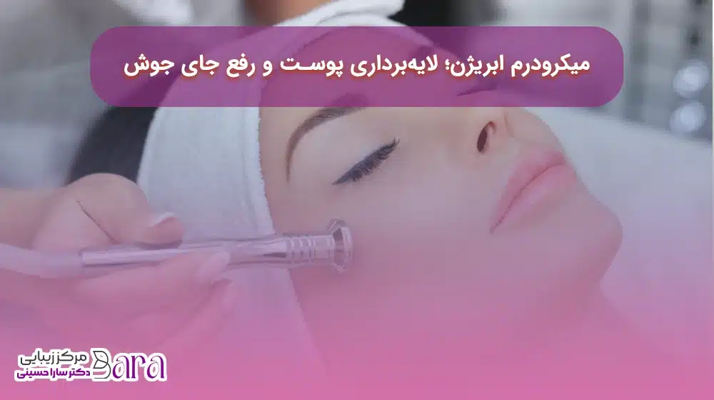 میکرودرم آبریژن؛ لایه برداری برای از بین رفتن جای جوش