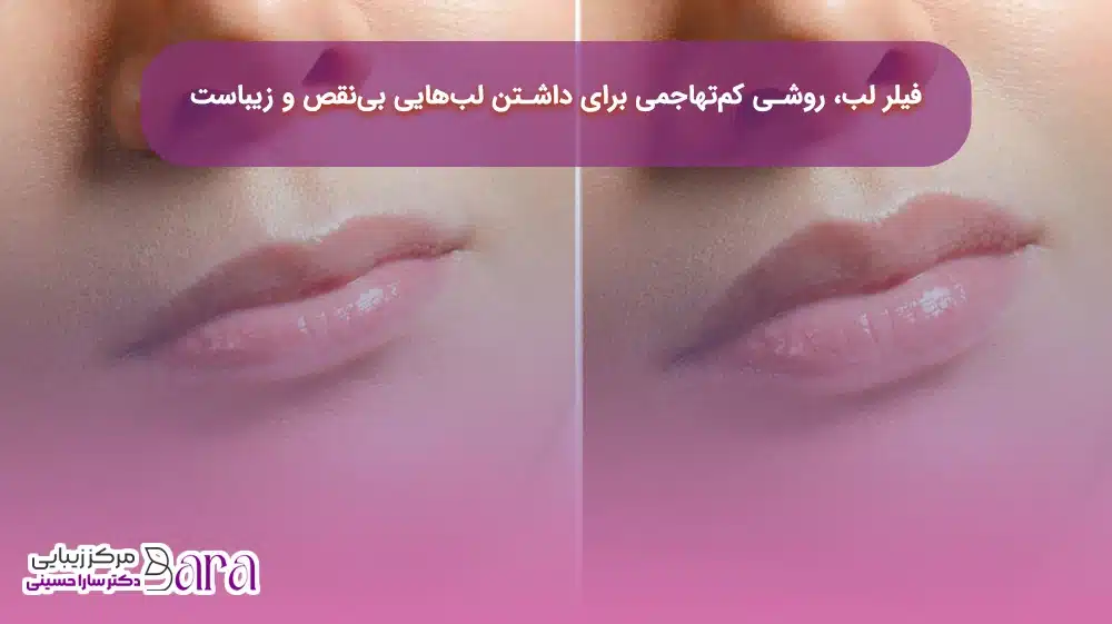 فیلر لب روشی کم تهاجمی تر نسبت به پروتز لب