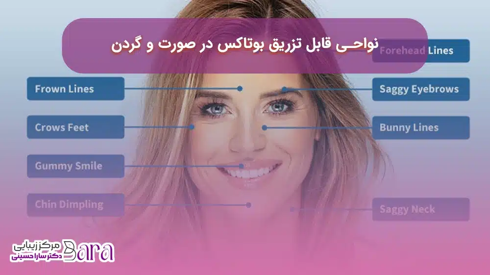 کاربردهای زیبایی و درمانی بوتاکس