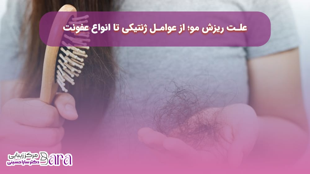 علت ریزش مو