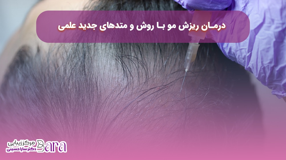 درمان ریزش مو